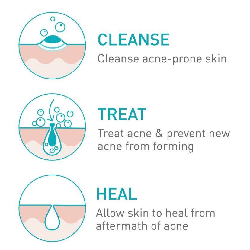 CeraVe Acne Foaming Cream Cleanser